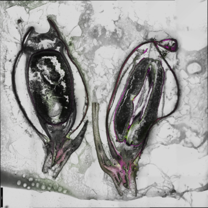 Microscopy of sectioned wheat grain tissue.